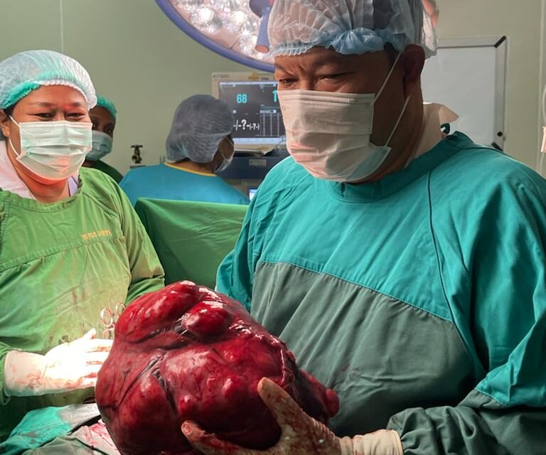 RSUD Jayapura Sukses Operasi Pasien Tumor Mioma Uteri Seberat 5,67 Kg