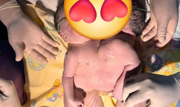 RSUD Jayapura Sukses Tangani Kelahiran Bayi Kembar Siam, Operasi Pemisahan Menunggu Hasil Pemeriksaan   